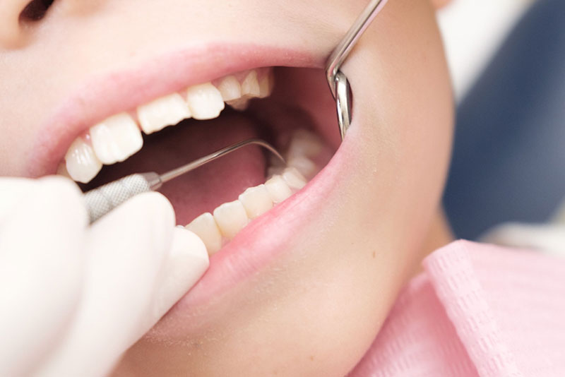 にいつま歯科　予防歯科　歯のメインテナンス